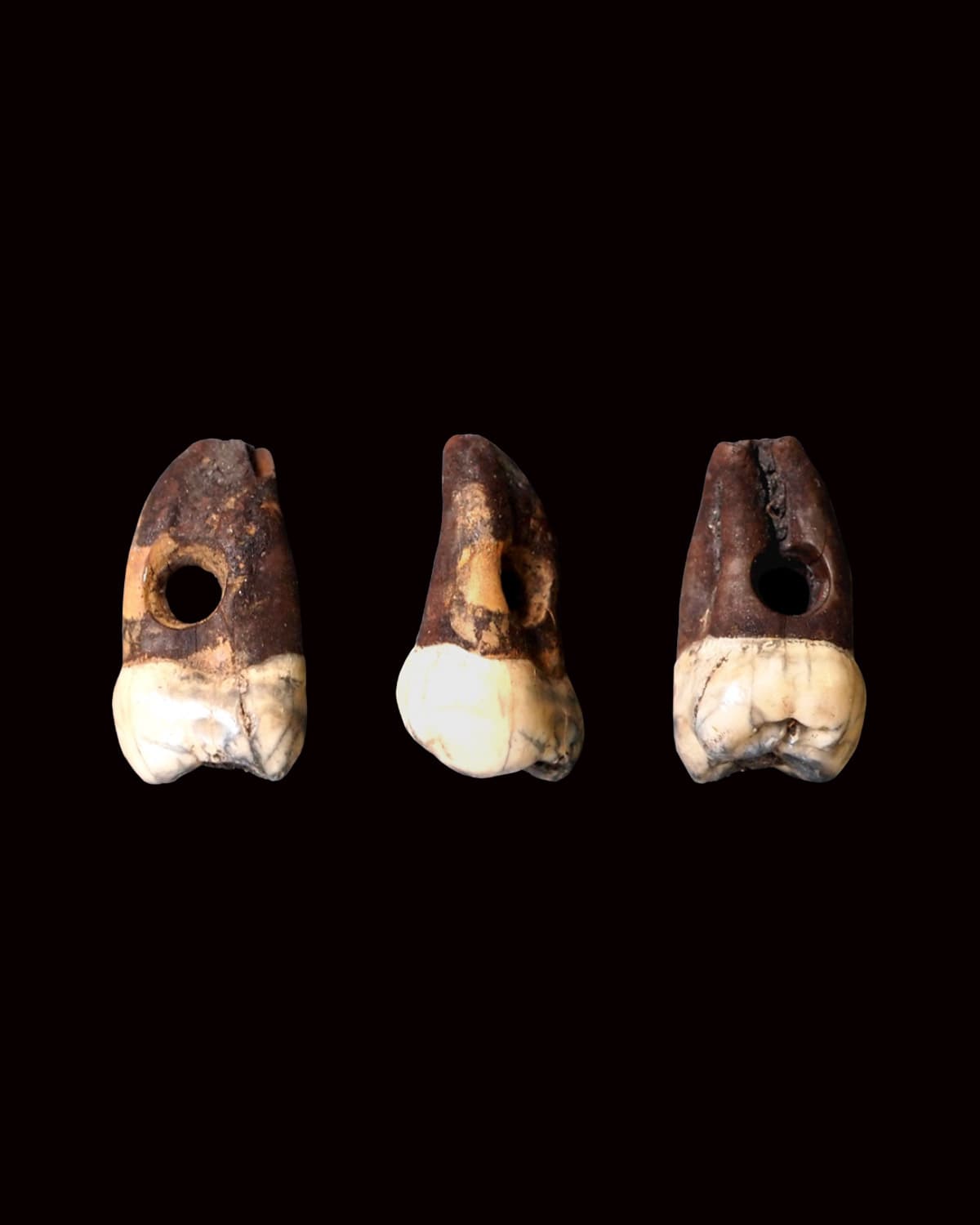 Dente molare umano forato dal deposito tardoneolitico (foto R. Micheli, archivio SABAP FVG).
